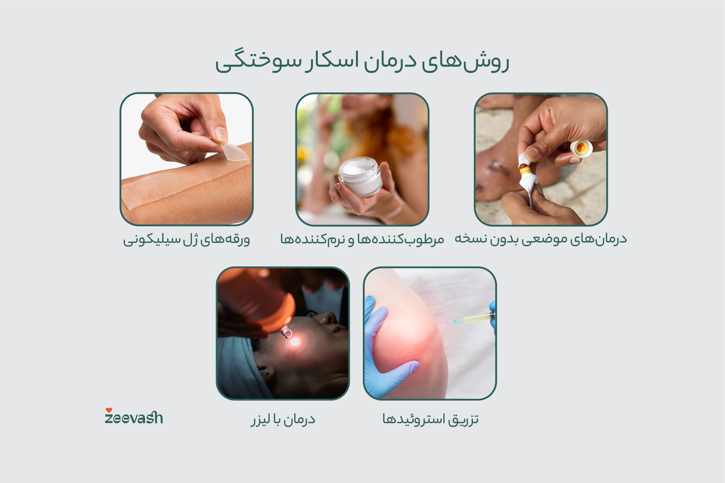 روش های درمان اسکار سوختگی